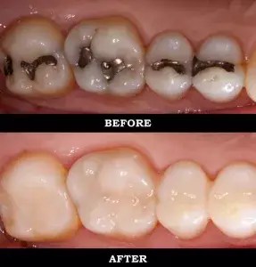 Dentist near me, dentista cerca de mi, best dentist miami, mejor dentista miami, pizza near me, chinese near me, food near me, crown dentist miami, cheapest dentist miami, root canal dentist miami, cheapest root canal miami