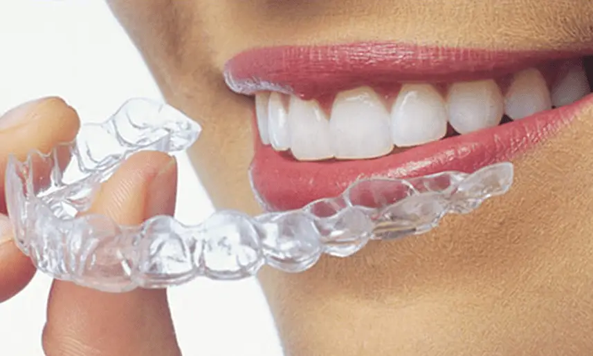 Alineadores transparentes y tratamiento Invisalign en Dr. G Dental Studio Miami
